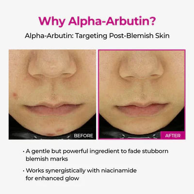 Dr.Melaxin Lumi Pore & Spot Care Duo