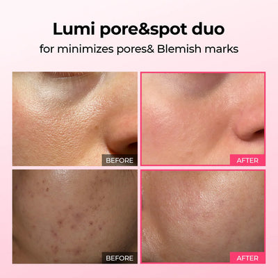 Dr.Melaxin Lumi Pore & Spot Care Duo